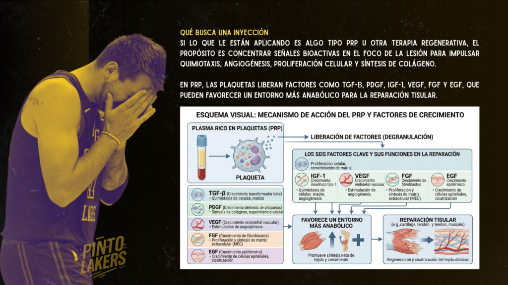 tratamiento de lesión de luka doncic en madrid